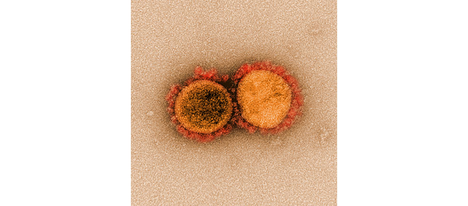  Coronavirus